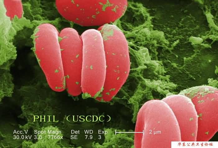 红细胞1（电镜图片）