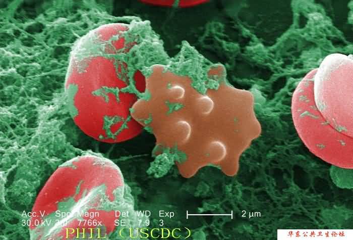 红细胞2（电镜图片）