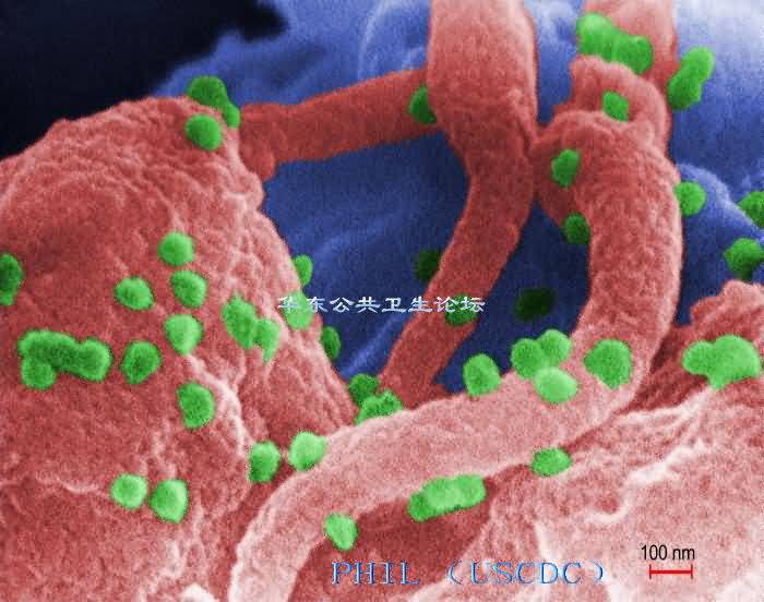 艾滋病毒（HIV-1）