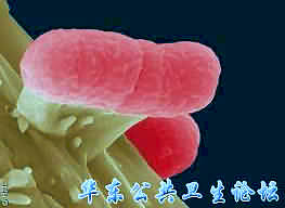 肠出血性大肠杆菌（EHEC）