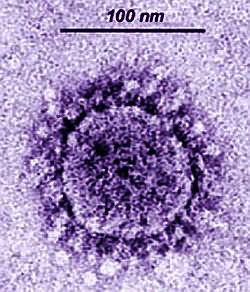新型冠状病毒 B