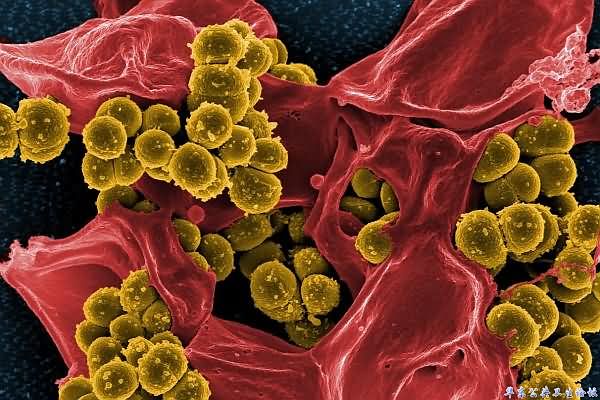 科学家在对耐药菌的个性化抗生素治疗上取得长足进步