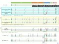 日本国内发现能削弱免疫功能的变异新冠病毒株（E484K）