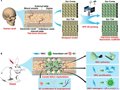 华南理工成功用3D打印仿扁平骨-生物陶瓷颅骨支架